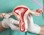Рак шейки матки: типичные симптомы